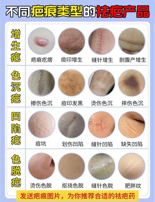 身上遍布疤痕是何种命运？疤痕体质者的寿命有多长？