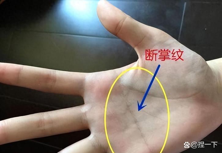 手相断裂预示着什么命格？这是否意味着命运将有重大转折？