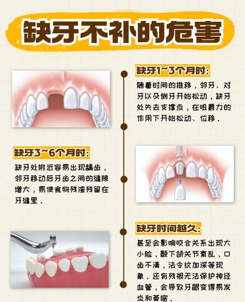 牙齿不美观是否会对家居风水产生不良影响？