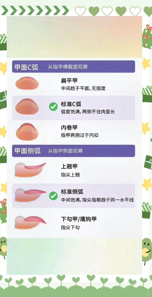 指甲形状拱代表什么命运？拱形指甲的命好吗？