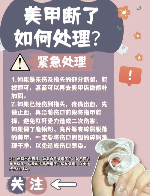 指甲断裂是否会对家居风水产生不良影响？