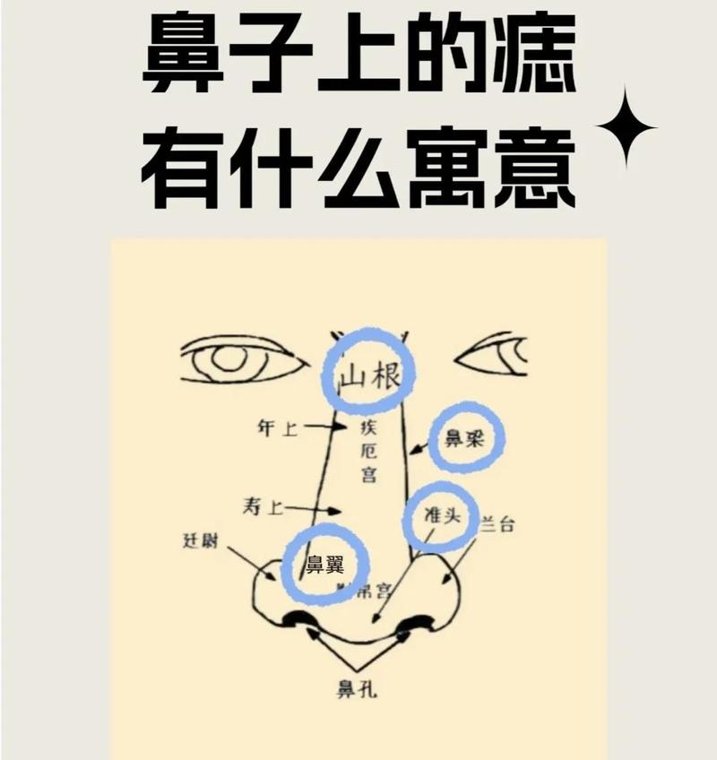 鼻子有痣对风水有何具体影响？