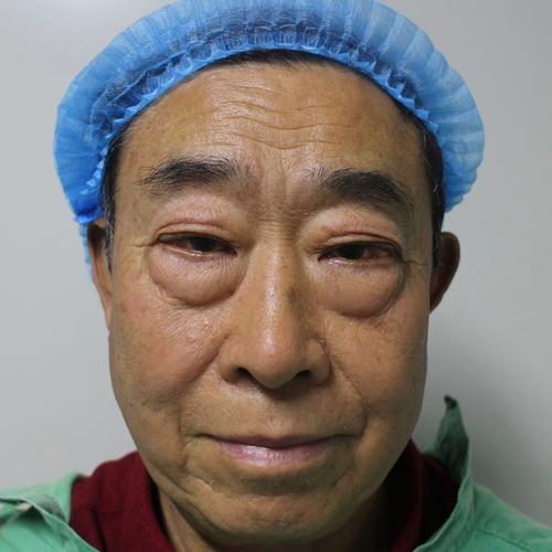 男人有大眼袋面相，命运会如何？