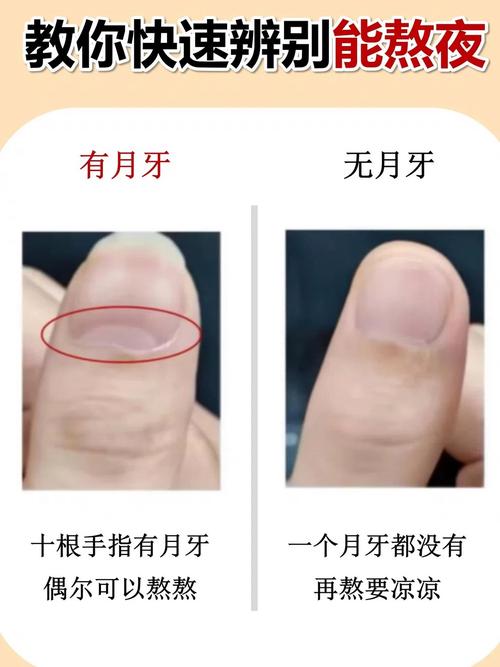 手指月牙缺失意味着什么命运？