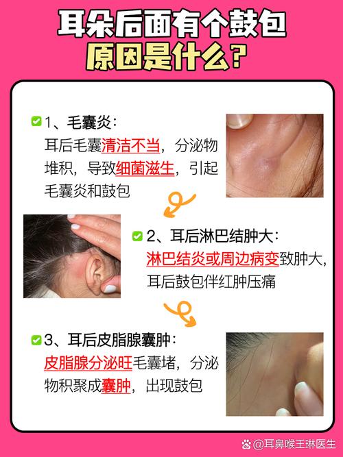 耳后骨头突出是何命？这种特征对命运有何影响？