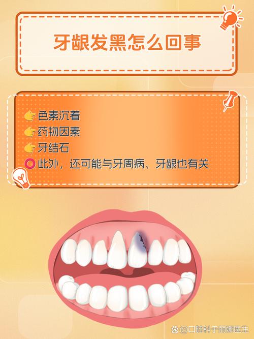 牙齿发黑是健康问题还是预示着什么命运？