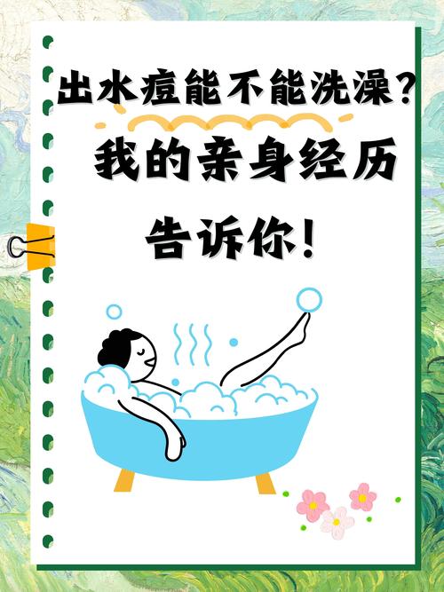 出风水疙瘩后，多久可以安全洗澡呢？