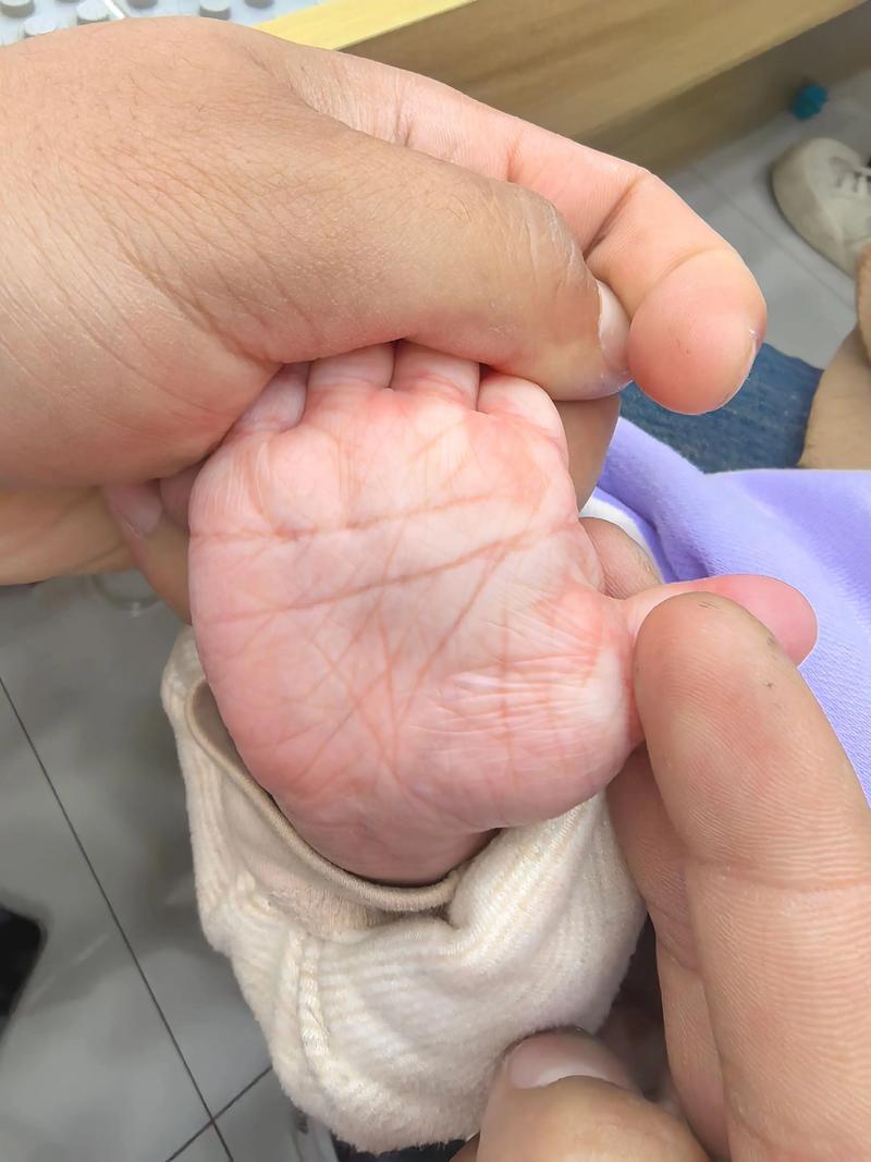 手心线条杂乱无章，手掌纹路混乱，这样的命运或性格特征意味着什么？