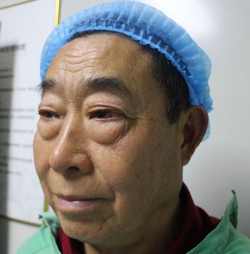 男人有大眼袋面相，命运会如何？