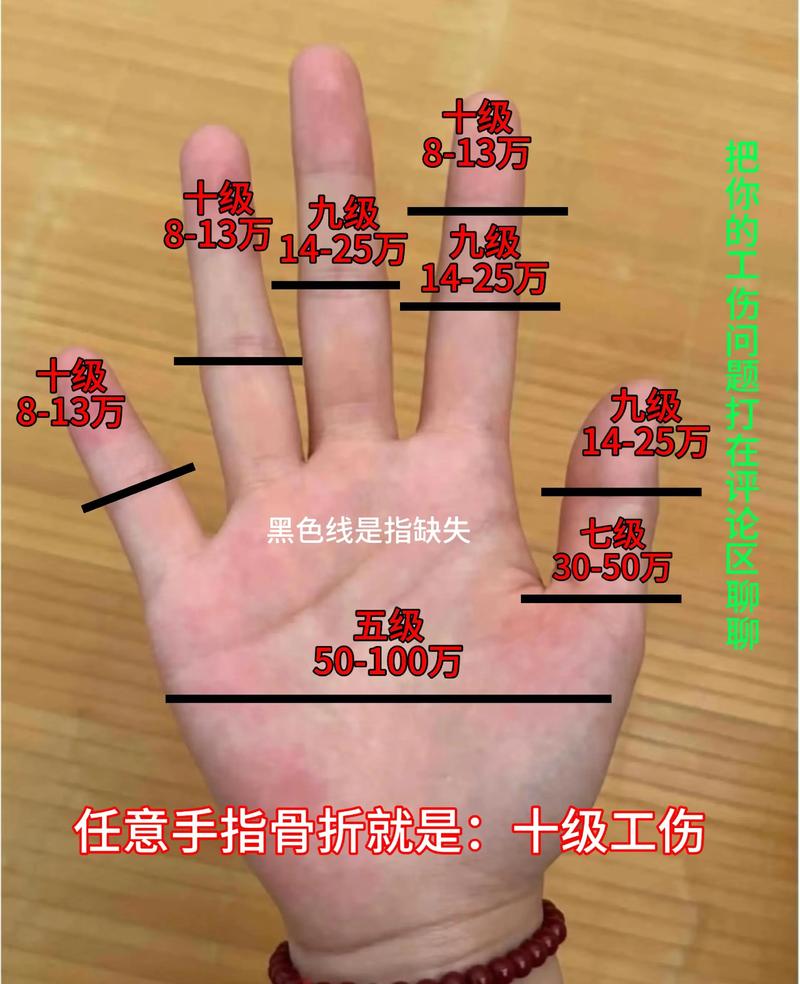 经常手部受伤的人命运如何？