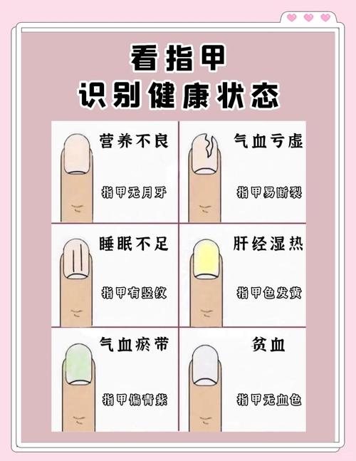 命硬命软分别指什么，指甲硬的人命运是否可改变？