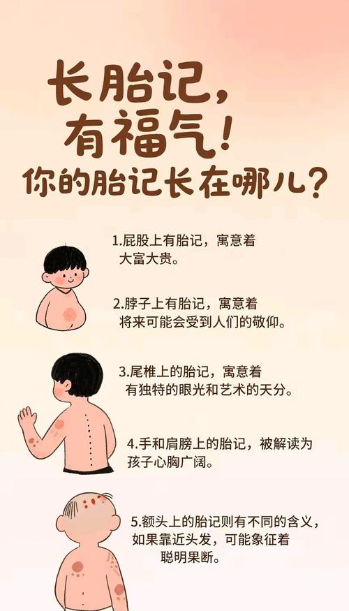 女人右肩胎记命运如何？这胎记预示着什么？