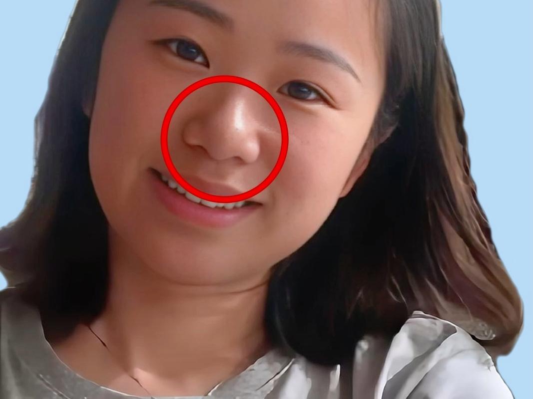 鼻孔大外露的命是否可以改变，命运如何？