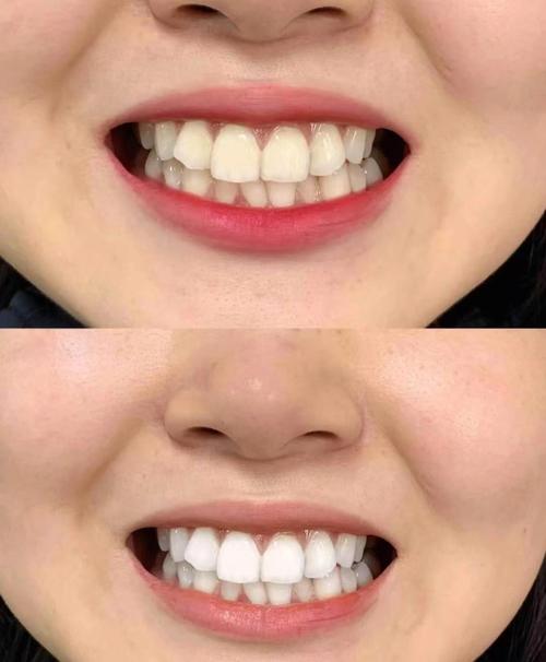 女人齿白整齐皮肤白面相如何改命？