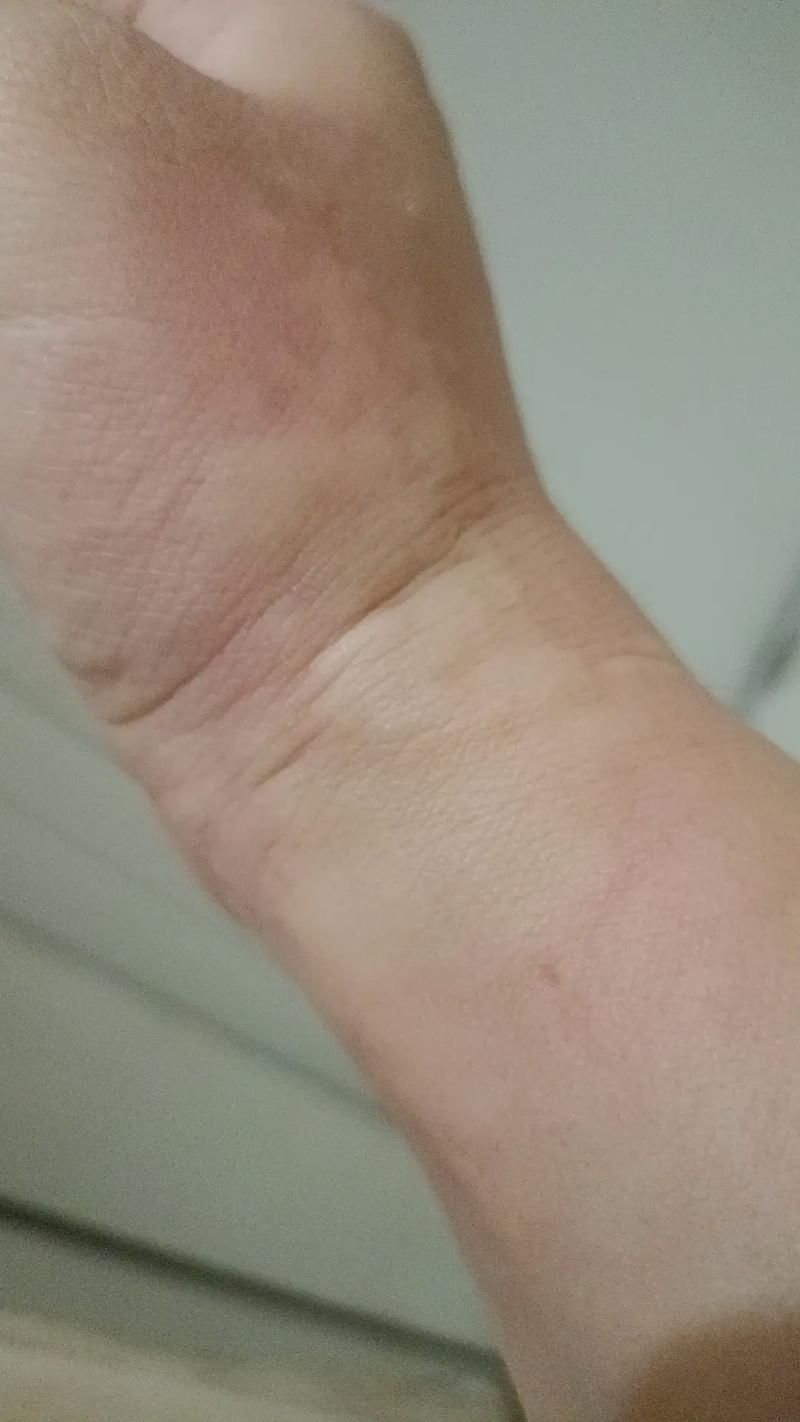 风水疙瘩会自己消失，还是需要采取措施才能去除呢？