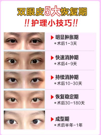 眼睛整容会对家居风水产生怎样的影响？