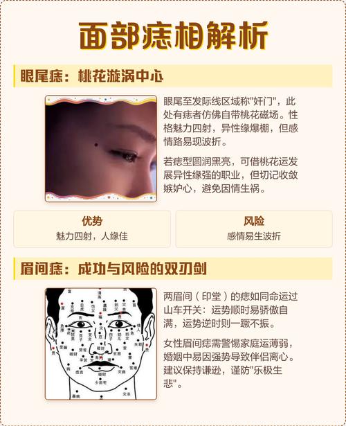 脸上有痣的人命运如何？为长尾？