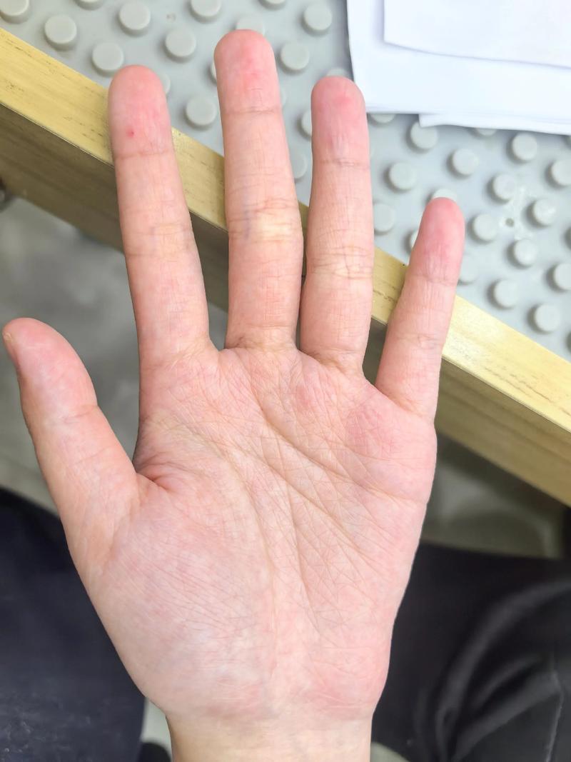 手心线条杂乱无章，手掌纹路混乱，这样的命运或性格特征意味着什么？