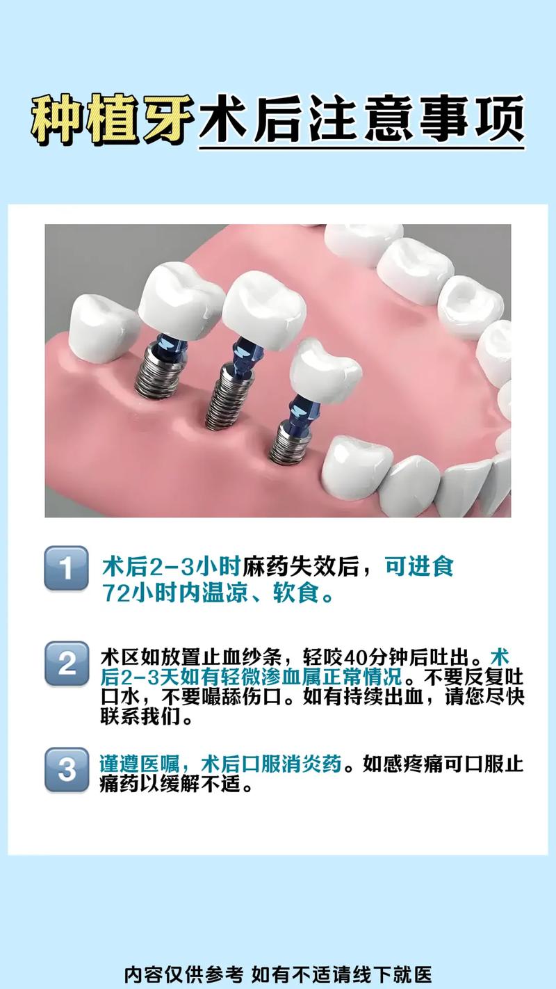 口腔种植手术有哪些注意事项？