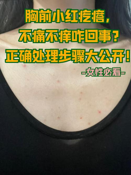 胸口长疙瘩是什么命？胸口前长许多红疙瘩是何命运？