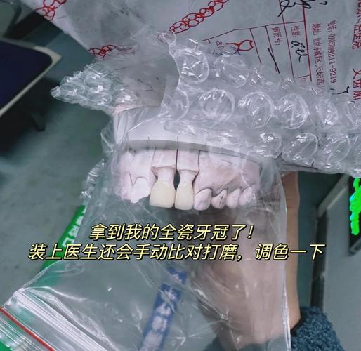 门牙整形真的能改变风水吗？这是真的吗？