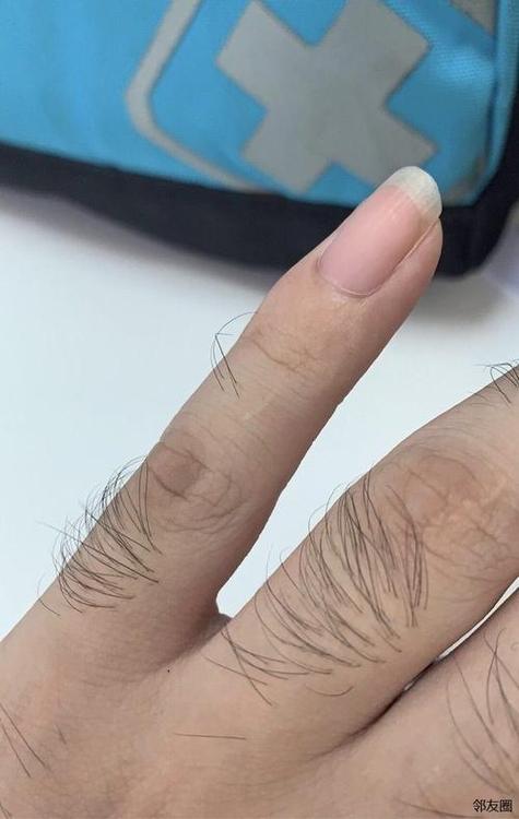 手指长毛预示着什么命运？