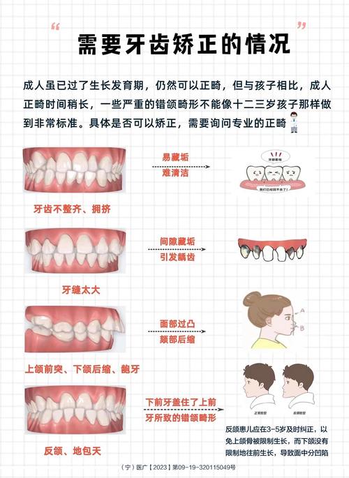 女性暴牙命运如何，民间说法有何解释？