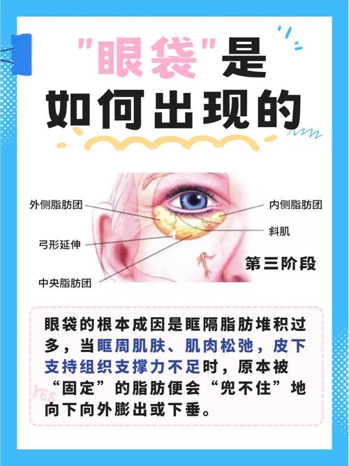 眼袋大是否会对子女的运势和风水产生不良影响？